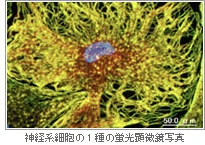 神経系細胞の1種の蛍光顕微鏡写真